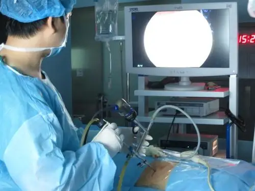肾结石手术展示 写美篇  近一周内我科完成多例复杂性肾结石微创手术