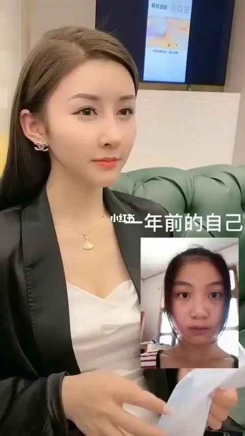 最近流行妈生脸,再想要不要整网红脸了,犹豫中