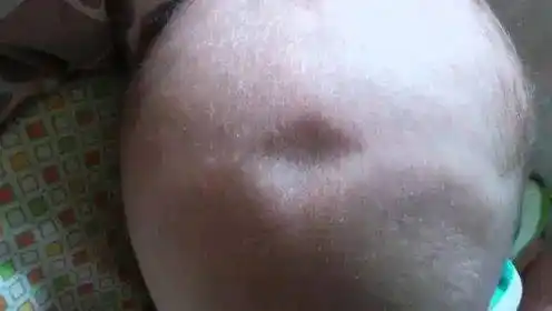 囟门命门宝宝囟门这个时候还没闭合就要注意了