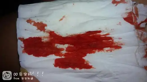 滴,今天早上就被痛醒了,总感觉下面有什么东西在流,一看,就流了好多血