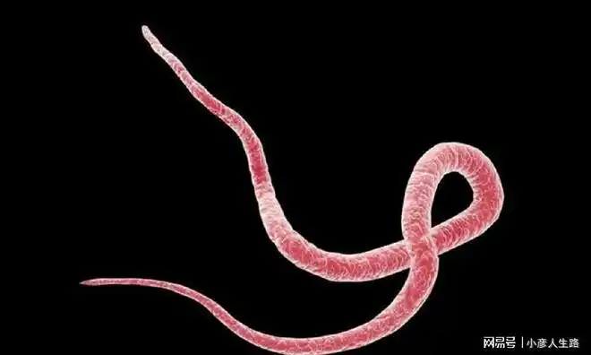 4岁儿子动不动就掏裤裆,不是坏习惯,而是蛲虫病在"作怪"|小青|宝宝