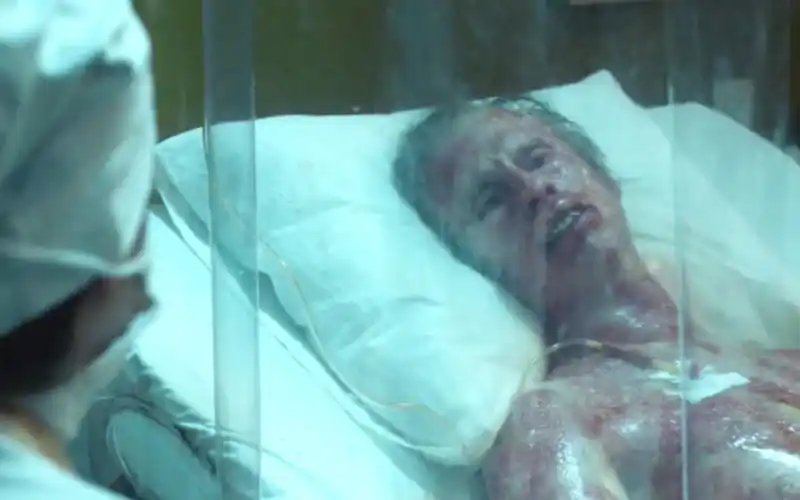 强辐射散发在空气中,人们忍受皮肤一点点溃烂而死,《切尔诺贝利》第三