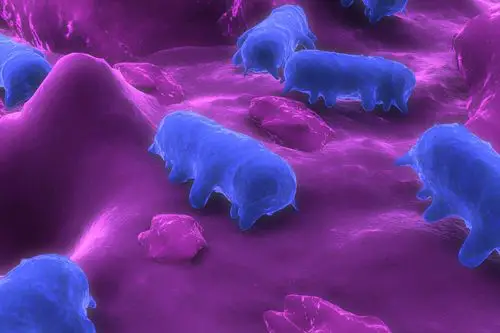 90 cases of salmonella reading infections linked to raw turkey