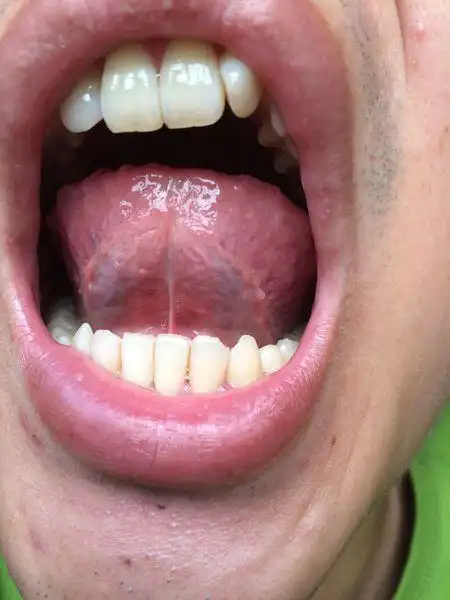 请问有什么问题吗,请说下.