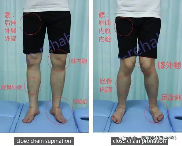 当膝盖从屈曲位到伸直位(最后的20~30°)时,胫骨会产生些许外旋的动作