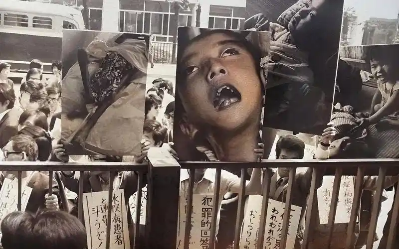 1956年,日本水俣病真实录像,5万只猫跳海自杀,人体畸形犹如贞子