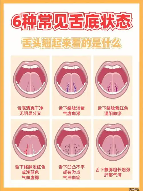 中医看诊会让你把舌头翘起来看的是什么71