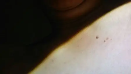 这是我左胸口长的,原因是我想小时候这里不知道为啥长疮,好了后,这里