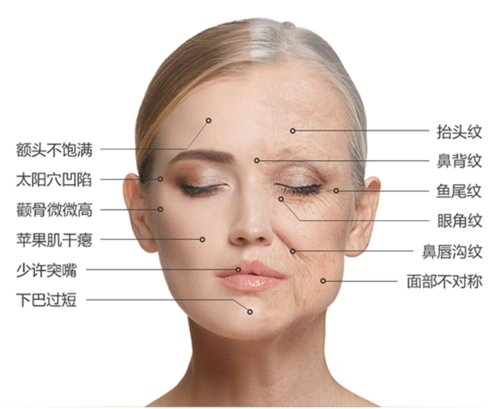 面部年轻化线雕,自体脂肪填充哪个好?