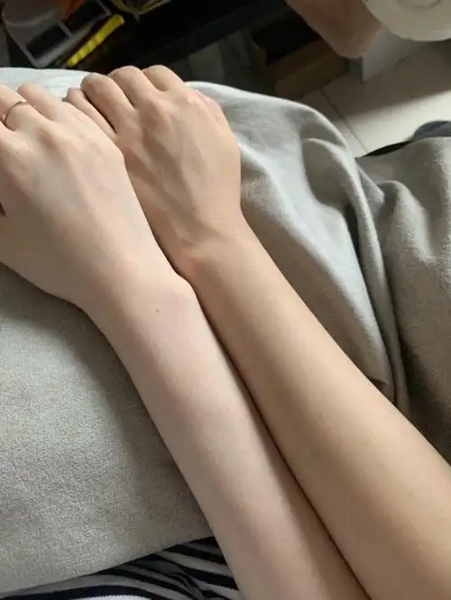 这是冷白皮和橄榄皮吗