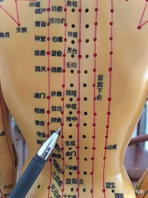 拔罐调理痛风 - 知乎