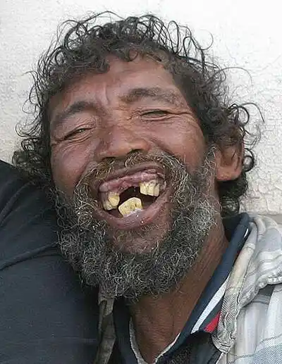 展开全部 是的,你怎么找到他这张照片的  追问 在百度搜最丑的男