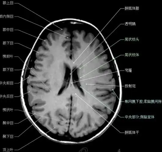 大集合颅脑轴向结构解剖图