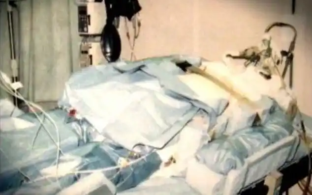 东海村核事故亲历者大内久:每天目睹身体腐烂,83天后去世