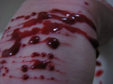 胳膊流血真实图片53