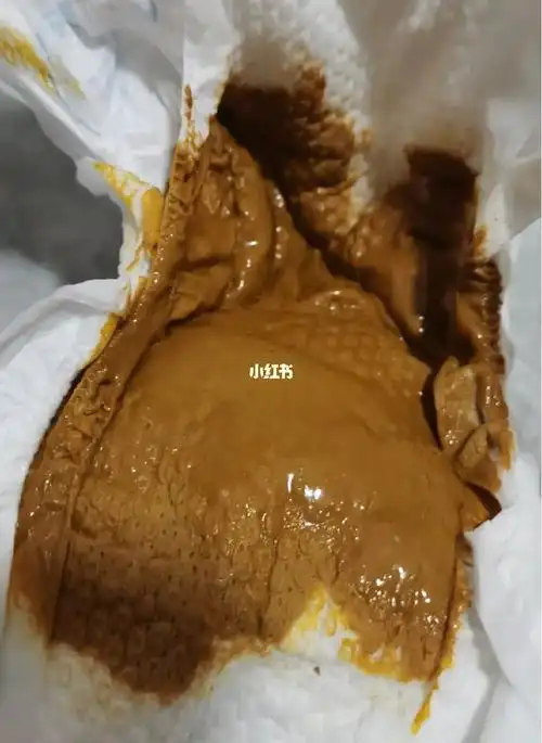 吃喝玩乐睡正常,从大便照片我们可以看出:大便呈黄棕色,糊状,量多,稍