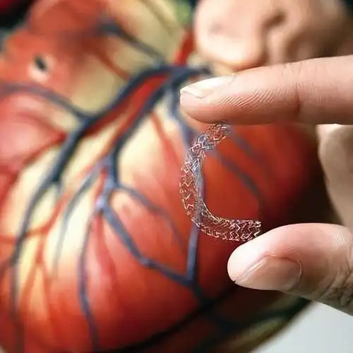 大概的内容就是指一些心脏病患者在进行心脏搭桥手术的时候,支架的