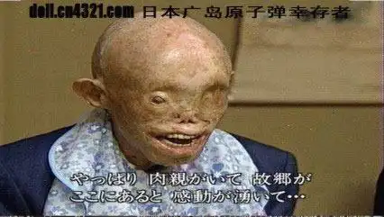 原子弹下的广岛长崎变异物种让人毛骨悚然