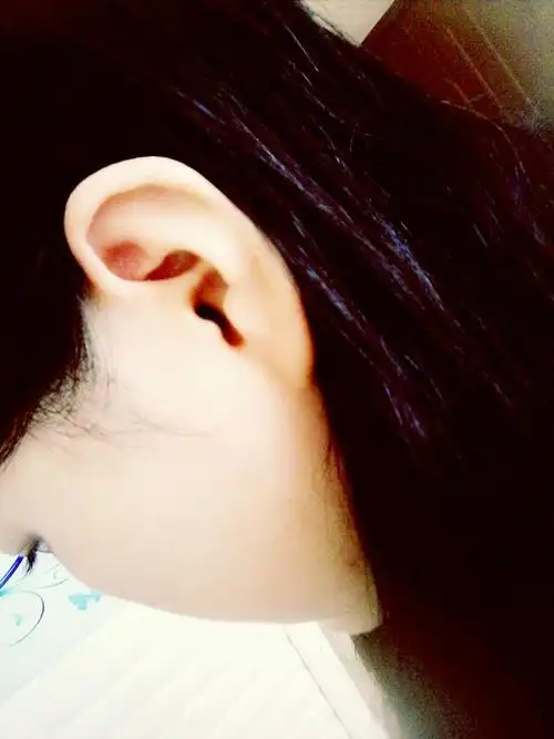 为什么耳朵是往外翻?_百度知道