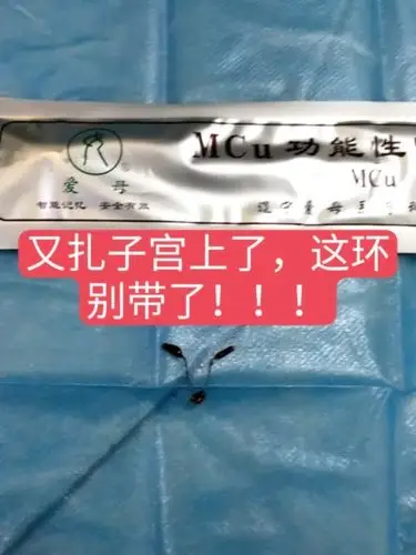 爱母环以后都别带了,乖,听劝! 23.