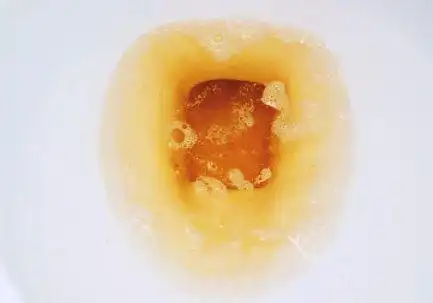 3,排尿困难尿酸盐结晶也需要经过泌尿系统排出.