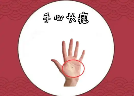 身体5颗"千金"痣, 有权有势, 儿女双全, 万里挑一的凤凰命!