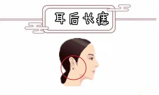 耳后长痣在相学当中,若是女人的耳朵后边的位置处长有吉痣,则往往会有