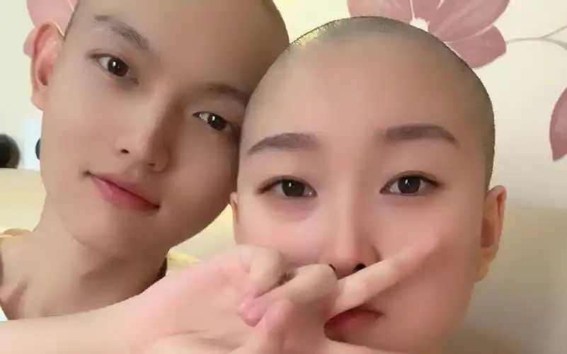 女生剃光头养发,男友陪同
