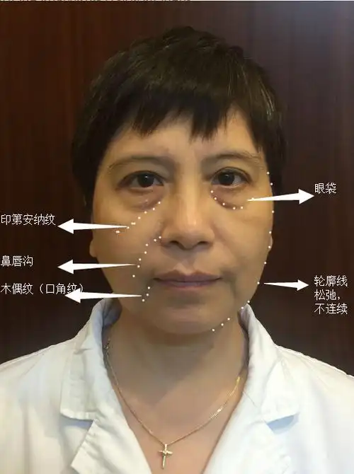 "三八线"让你老了不止10岁,这样做就对了!