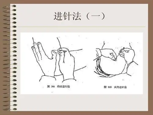 针刺基本手法之进退针法