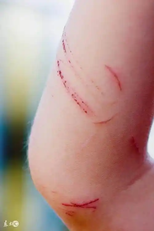 小区里的熊孩子抓伤了我家孩子,结果不讲理的奶奶把我吓到