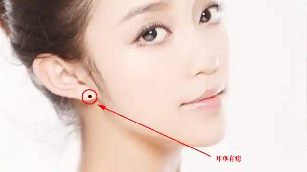 身上有这几颗痣,你的人生迟早会开挂,注定发大财