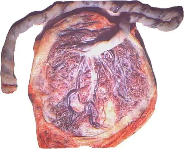 前置胎盘,你了解多少?|胎儿|妊娠|母体|子宫内膜_网易订阅