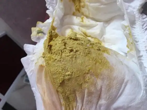 半个月宝宝的大便,有点发白,这是什么情况?