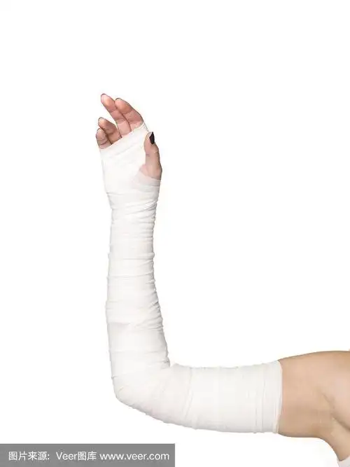 手臂上的绷带