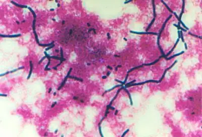 显微镜下的乳酸菌