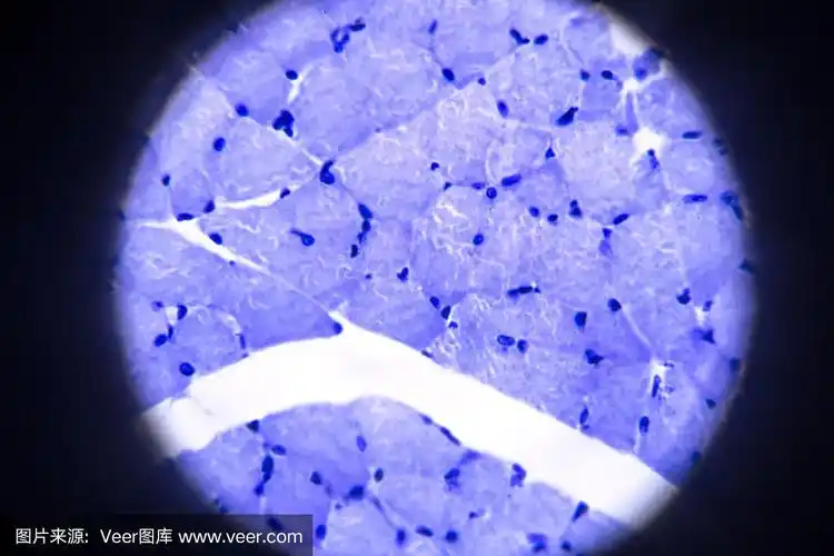 显微镜下骨骼肌横切面