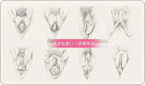 这是一组_圈子-新氧美容整形