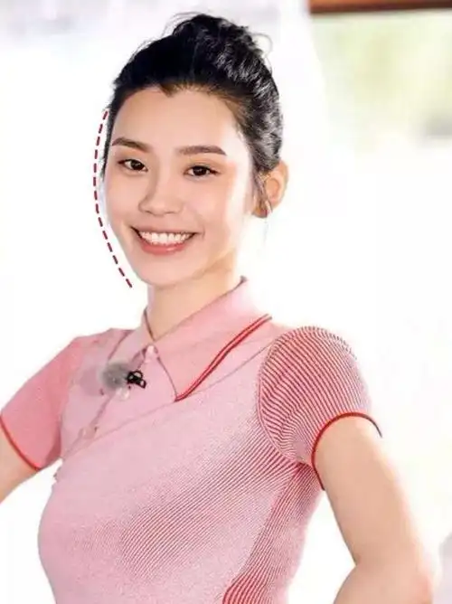 如何分辨,是颧骨高还是太阳穴凹陷?