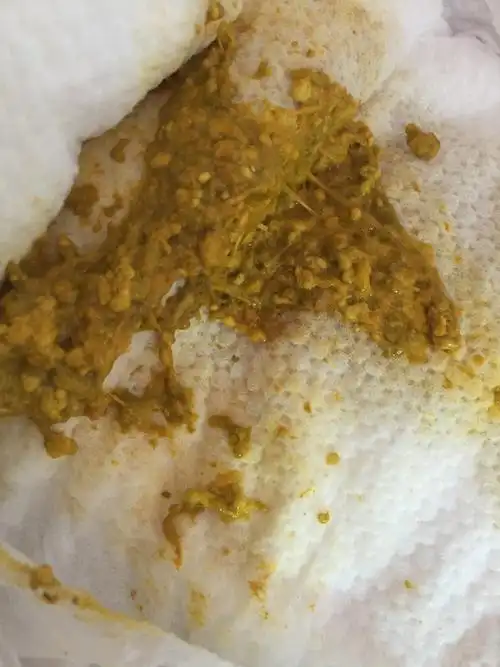 这个消化不良算严重的吗?大便一直又股酸臭味!宝宝还在月子中,咋整?