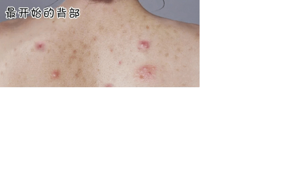 爱穿露背装小吊带的女生露出这个东西也太太太难看了吧