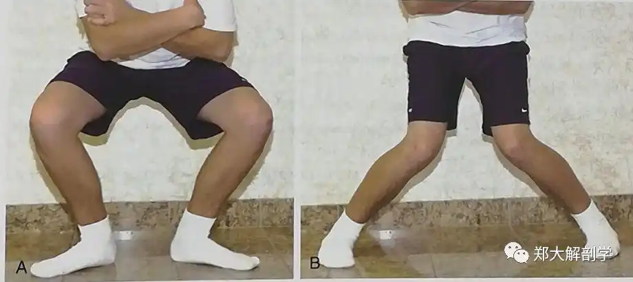 八种引起膝关节的疼痛综合征Ⅰ