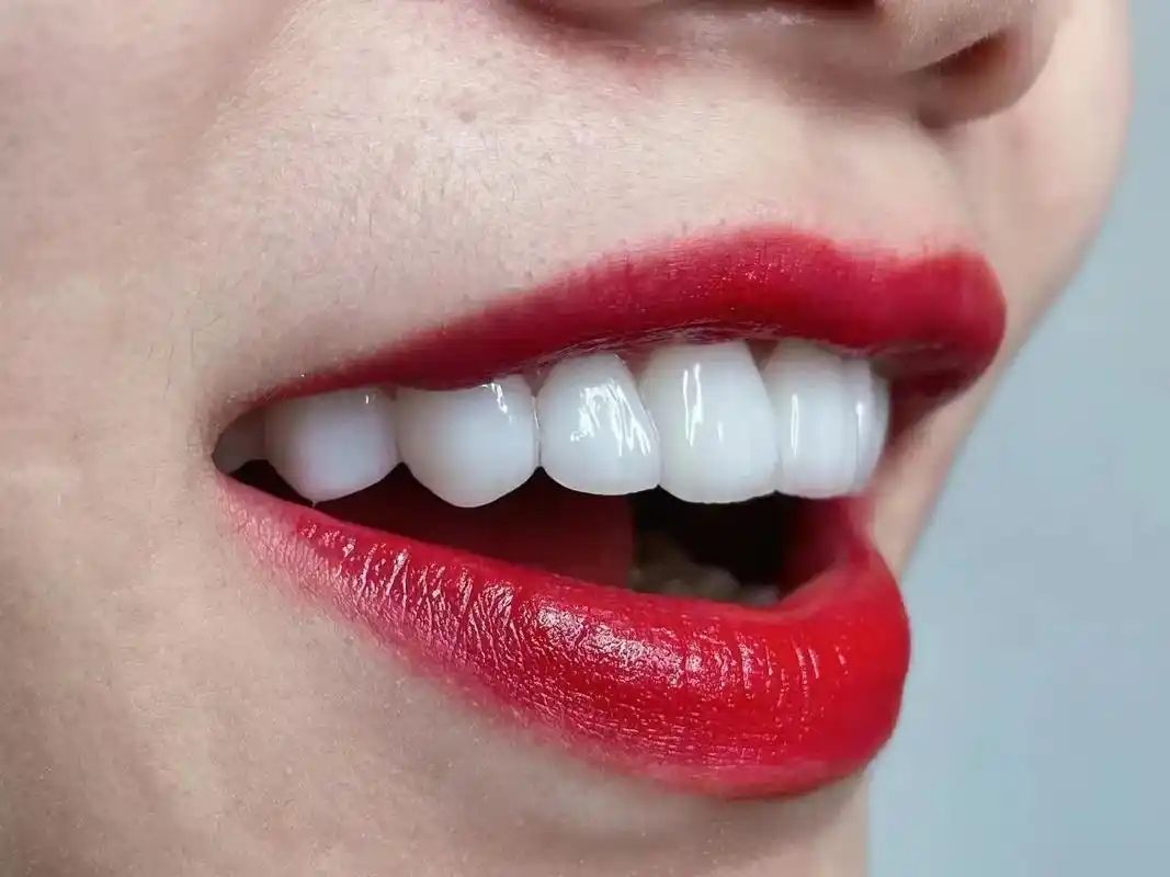 有一种美 叫作"笑容杀"  当你露牙微笑的那一刻 整个世界都 - 抖音