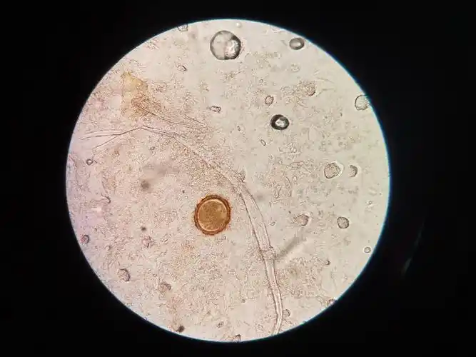 镜下查找到的蛔虫卵