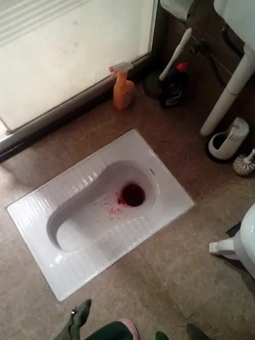 医生你好之前一直便秘情况导致痔疮上厕所会有血可是不多疼痛剧烈