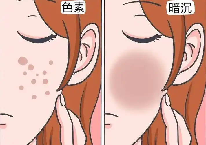 为什么疤痕有黑色素沉着?应该怎么去除?_治疗_皮肤_护理