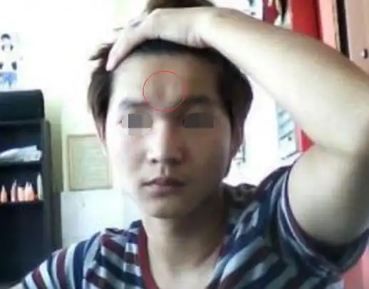 面相算命:印堂凹陷的人,三十岁前多灾多难,三十岁后幸福多金_女性