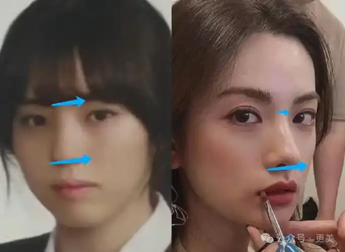 综上她对鼻子的诉求可能有两点.