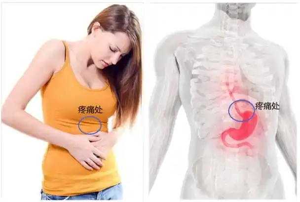 剑突下 剑突下不适是什么原因