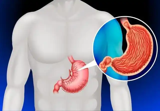 主治医生忠告:日常服1素,有助通透胃部,防范癌变这1素:绣杆菌粉营养素